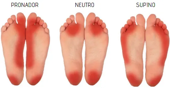 Patines para adultos - 3 tipos de dolores de pies